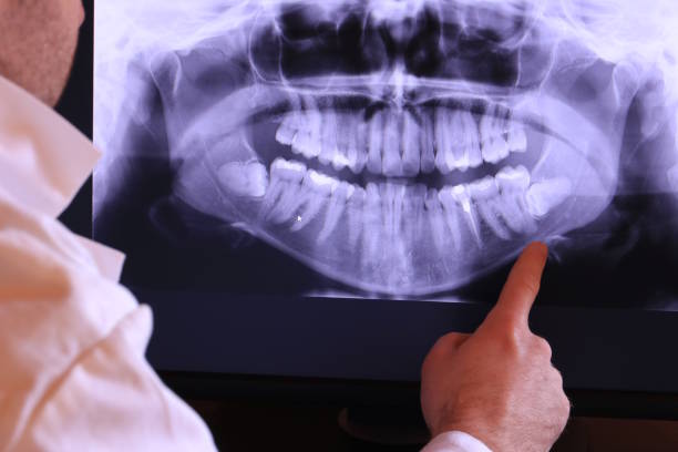 Best Same-Day Emergency Dental Services in New Tazewell, TN